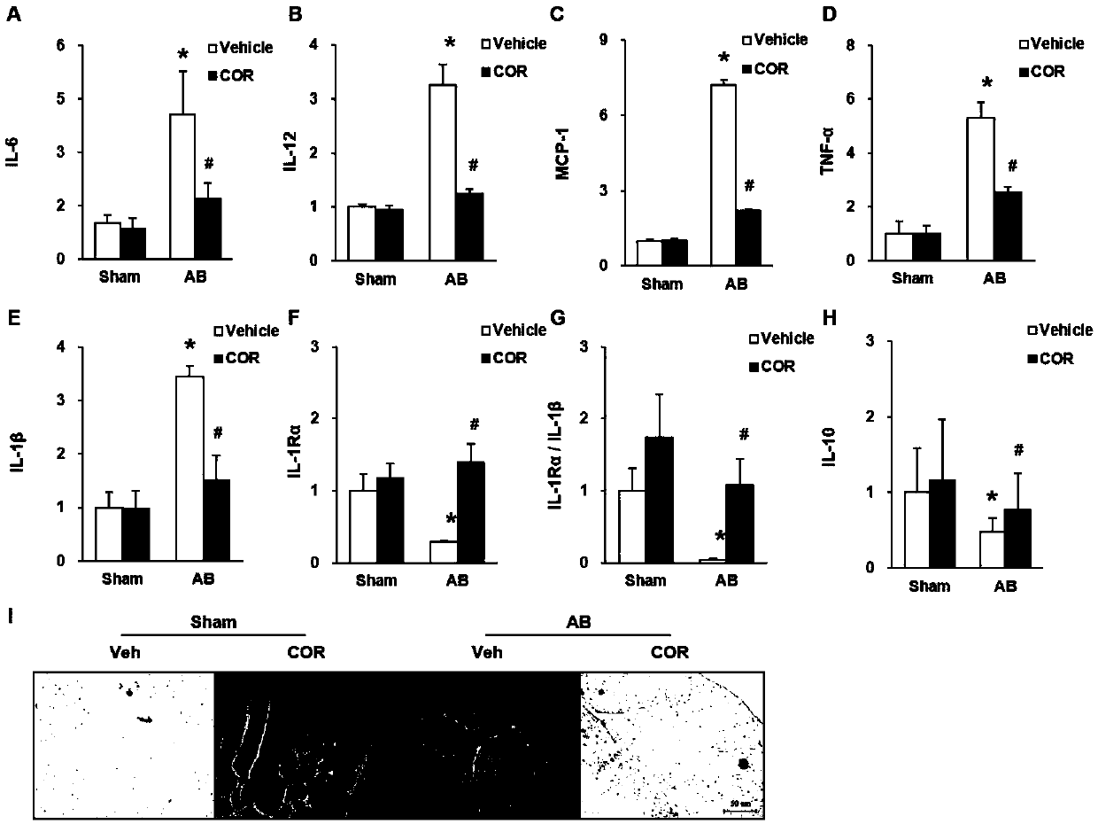 Use of corilagin in preparation of anti-myocardial fibrosis medicines