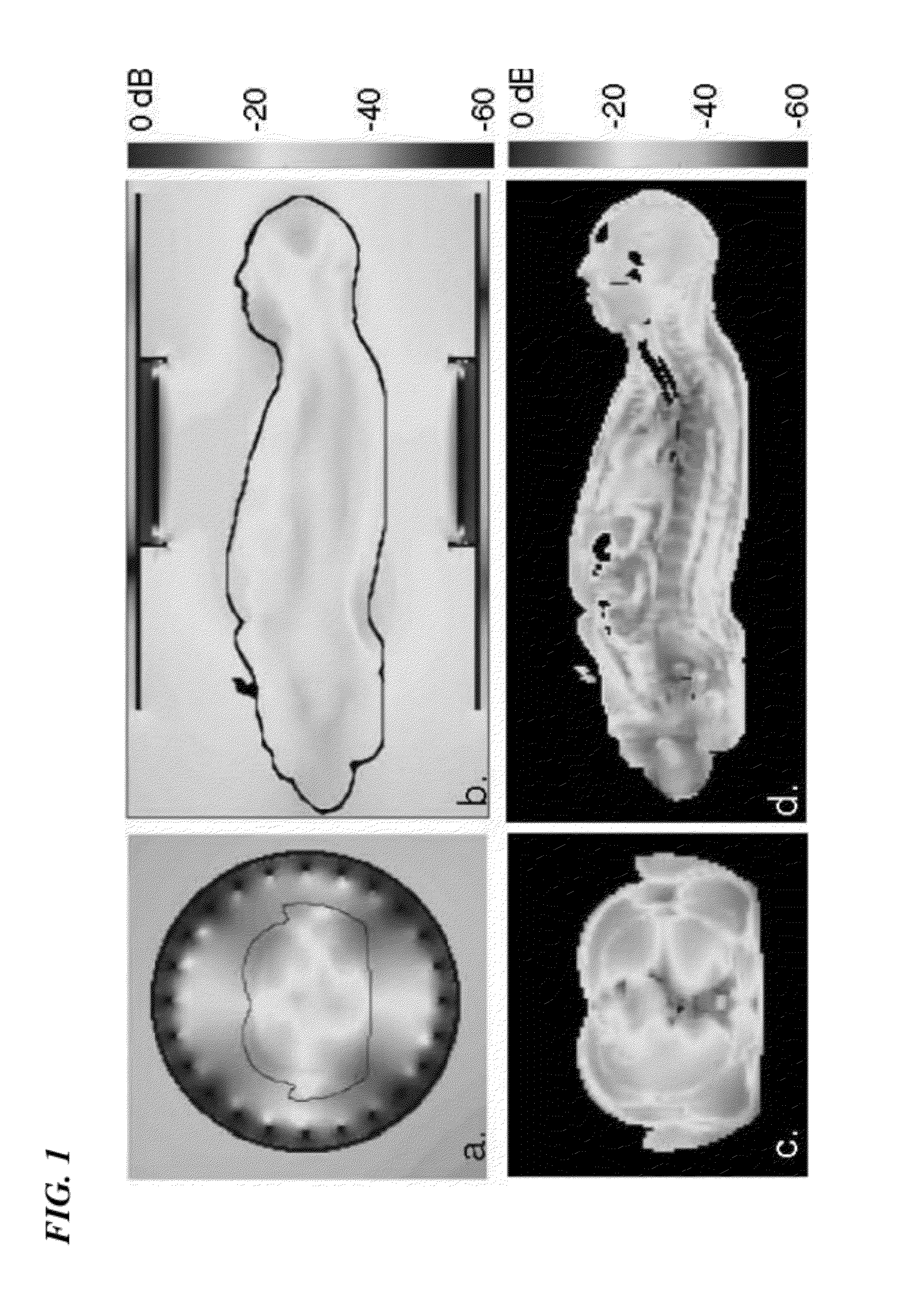 Method and coils for human whole-body imaging at 7 t