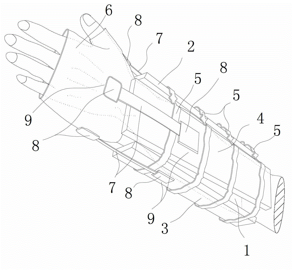 External fixation treatment device for distal radius fracture