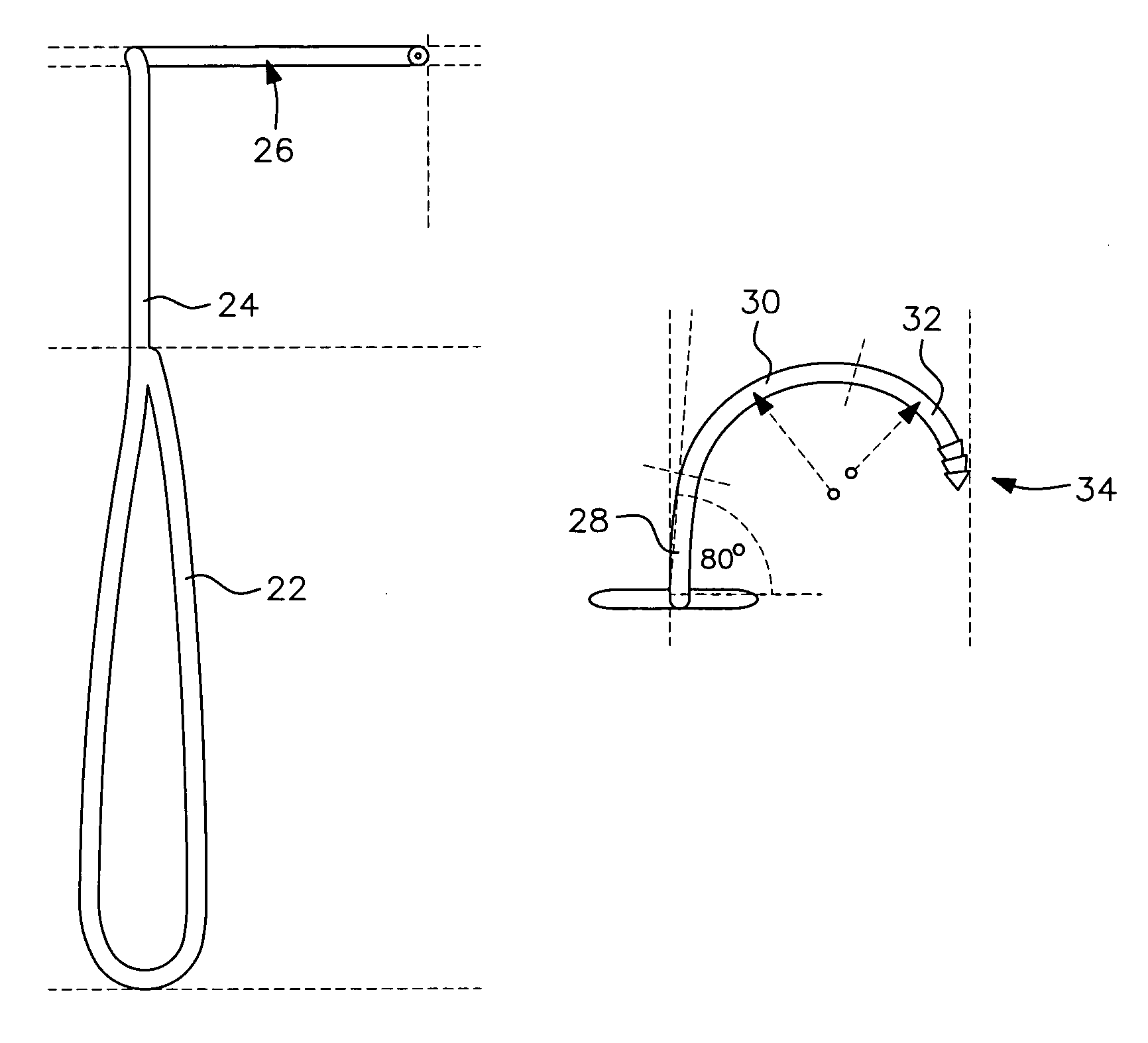 Surgical technique and tools for use in treatment of male urinary incontinence