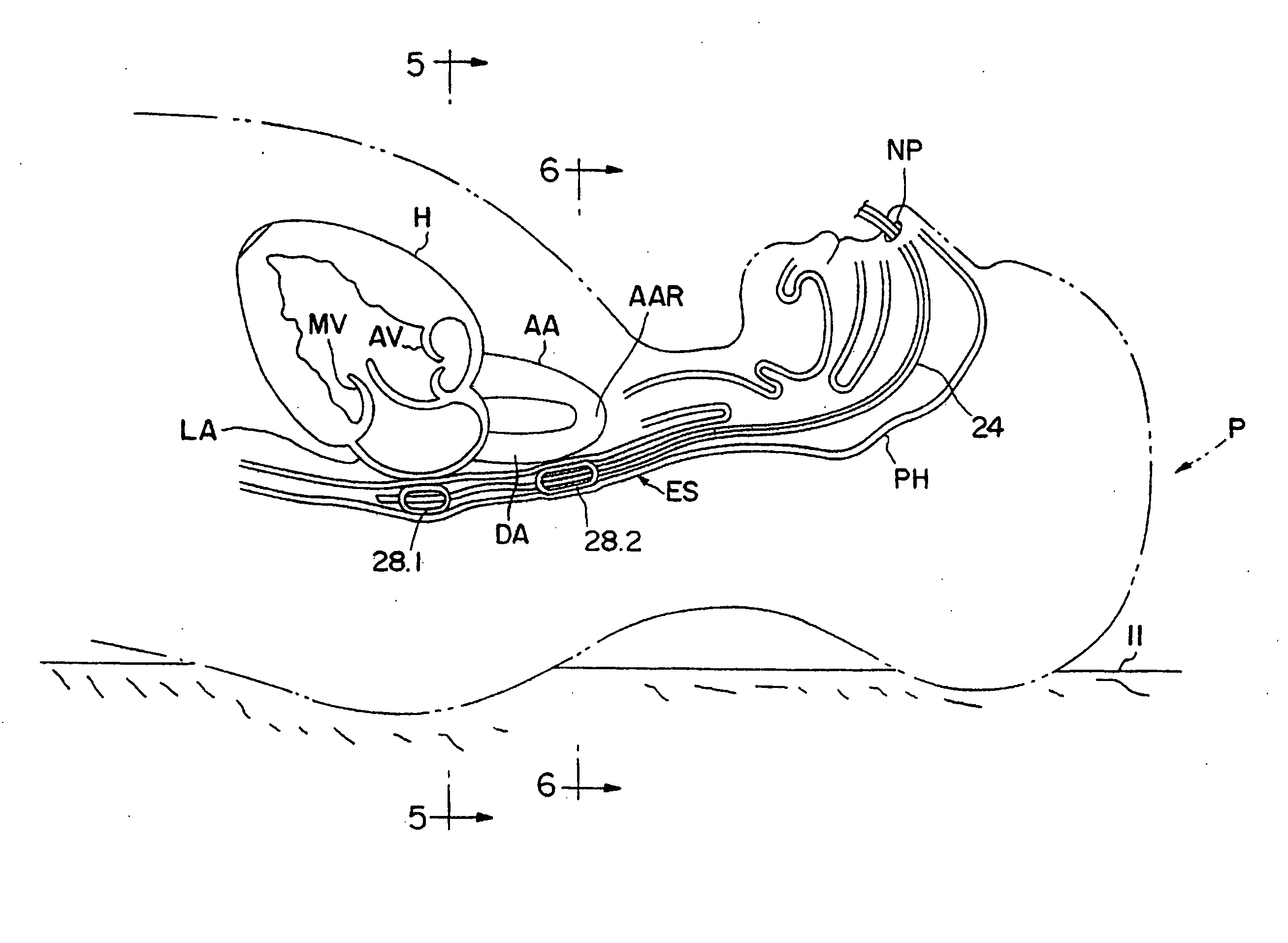 Method of determining cardiac indicators