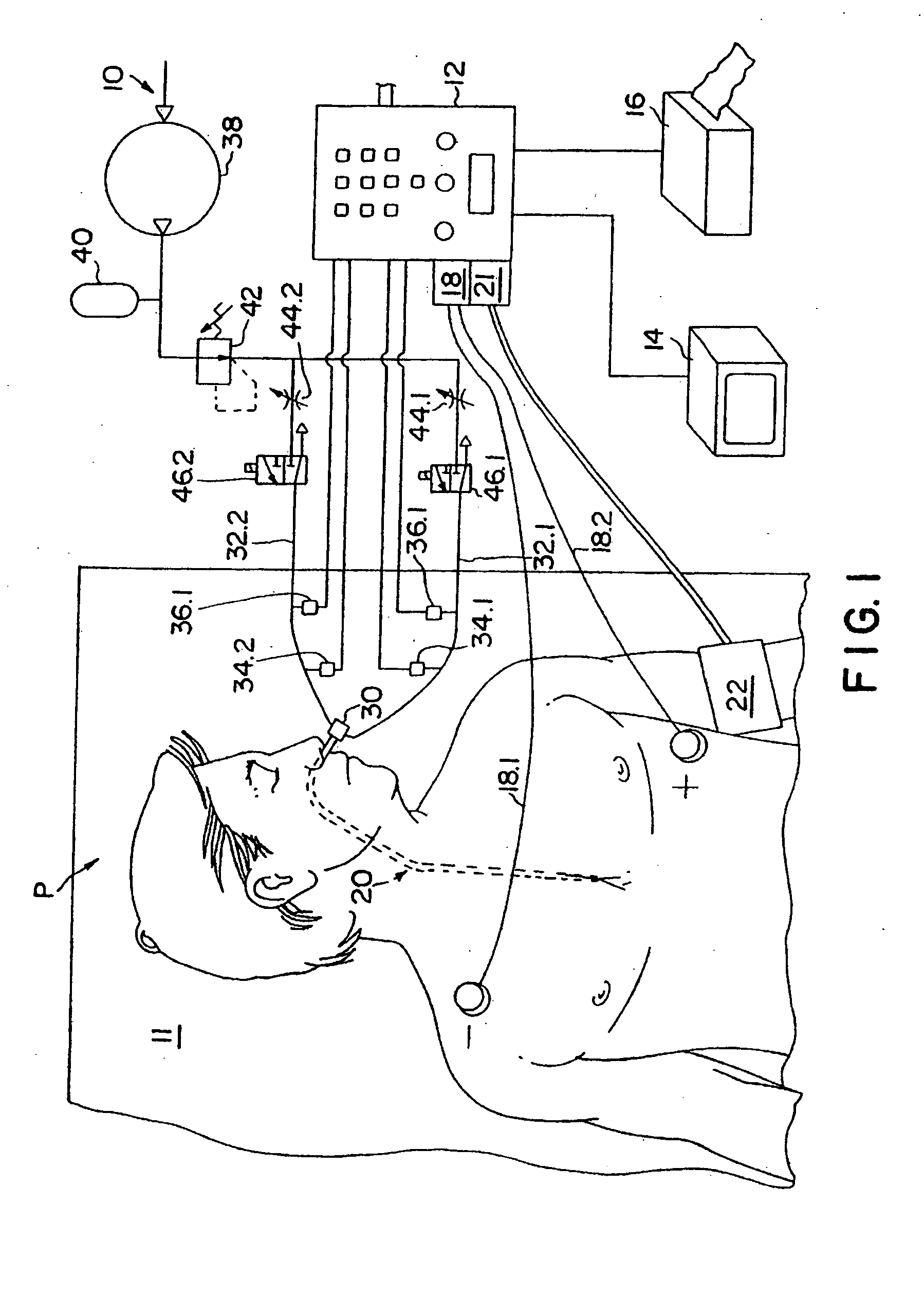 Method of determining cardiac indicators