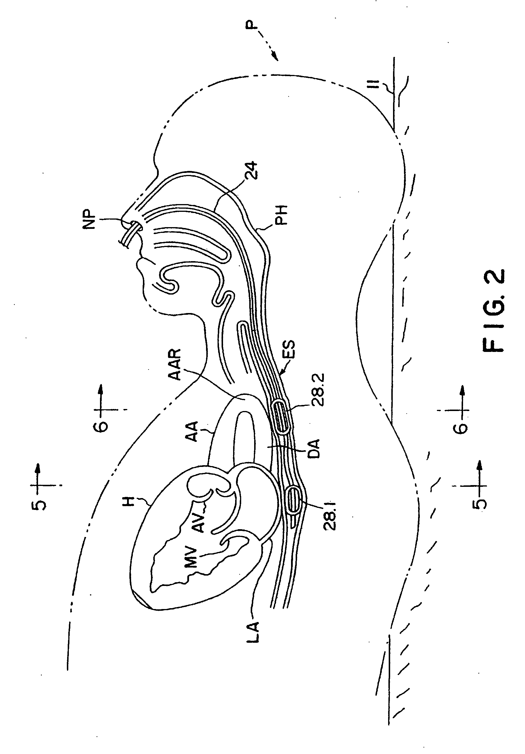 Method of determining cardiac indicators