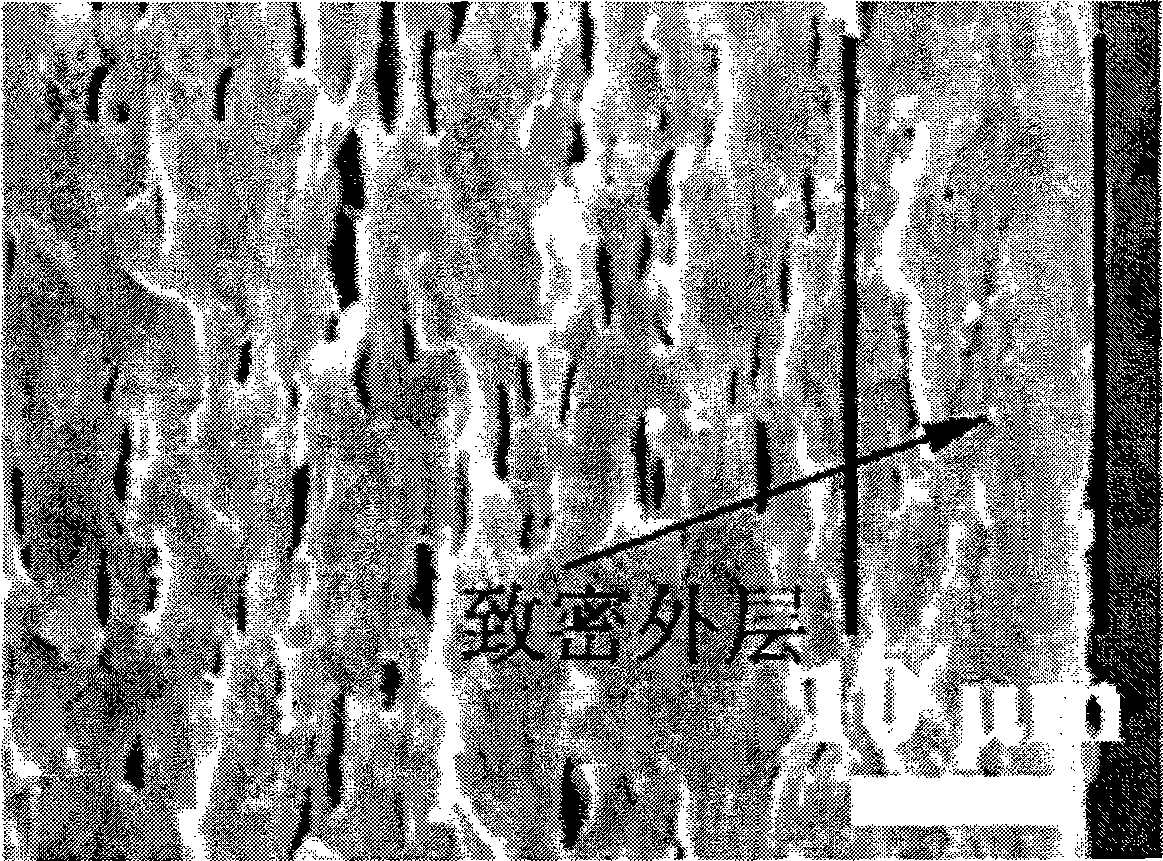 Gelatin/calcium phosphate asymmetry medicine releasing coating layer and preparation method thereof