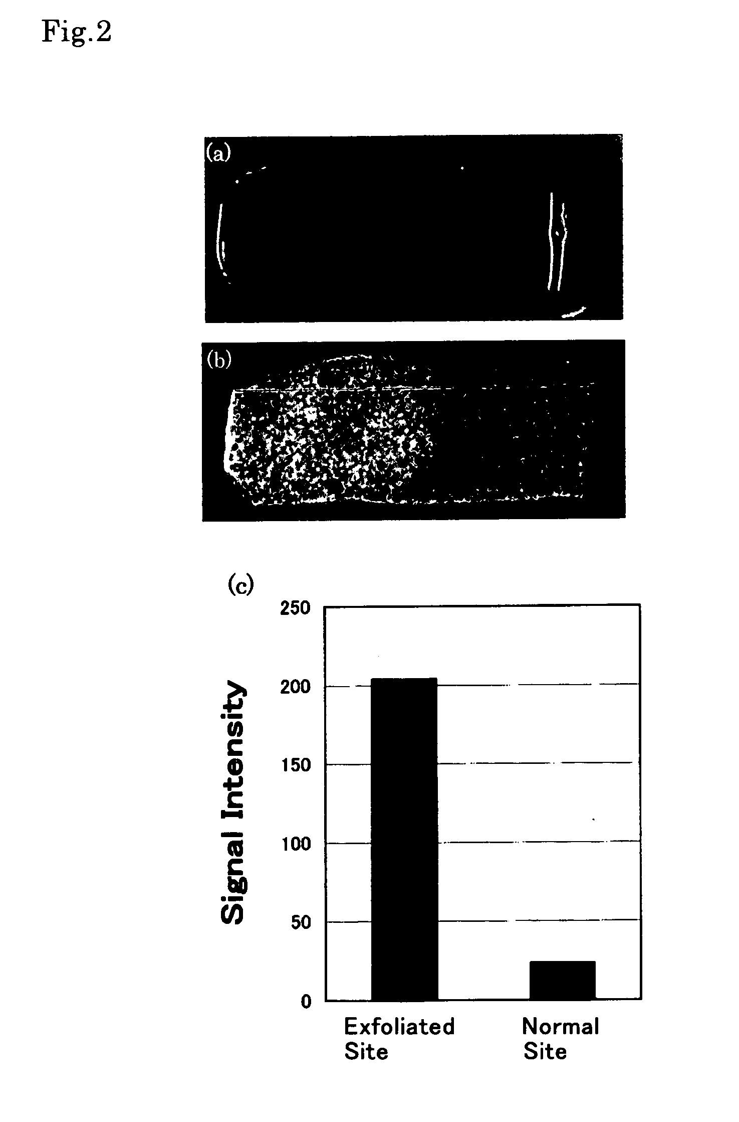 MRI contrast agents