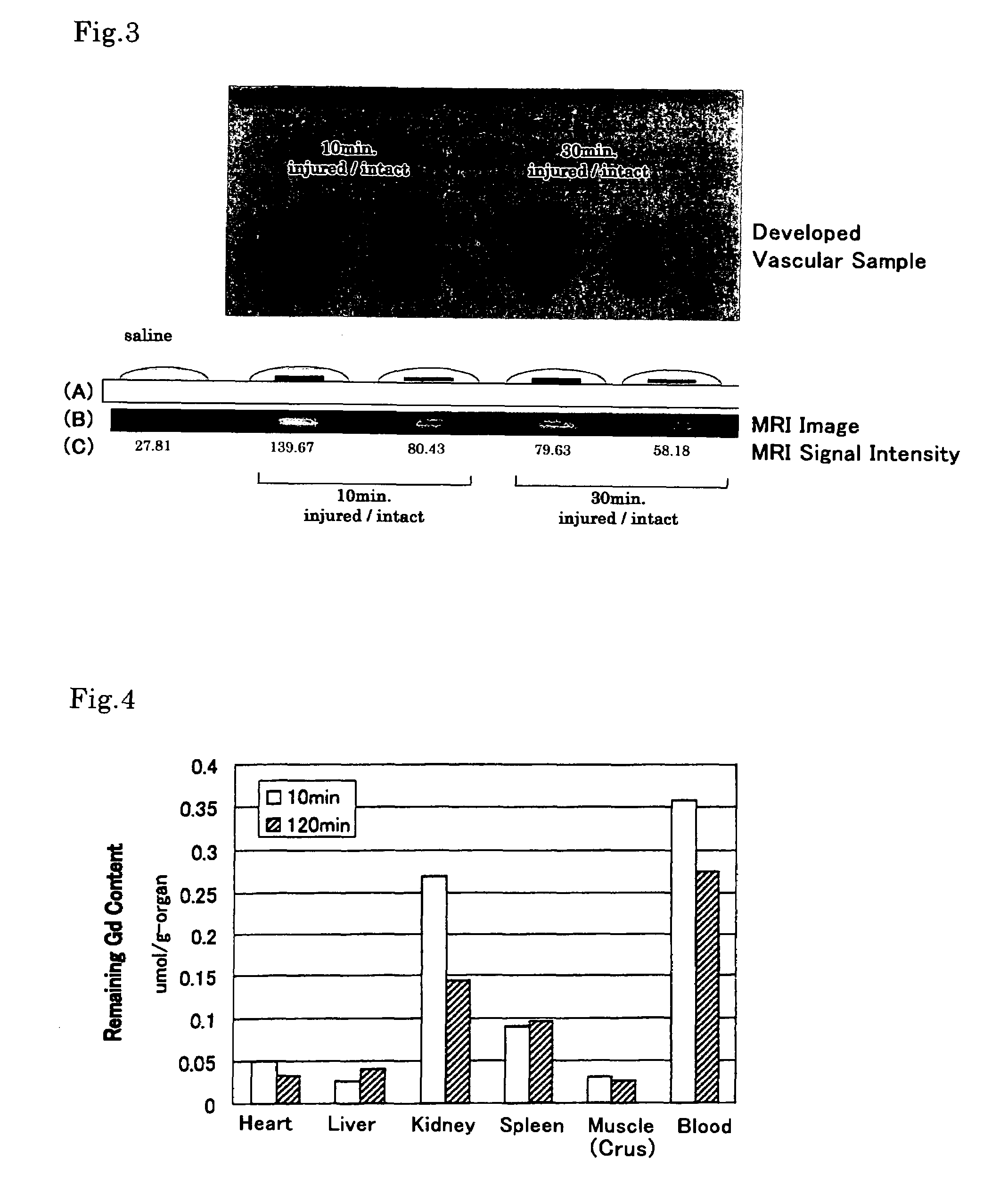 MRI contrast agents