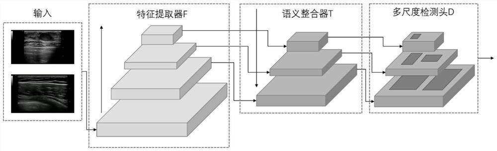 Medical image focus detection modeling method, device and system based on federated learning