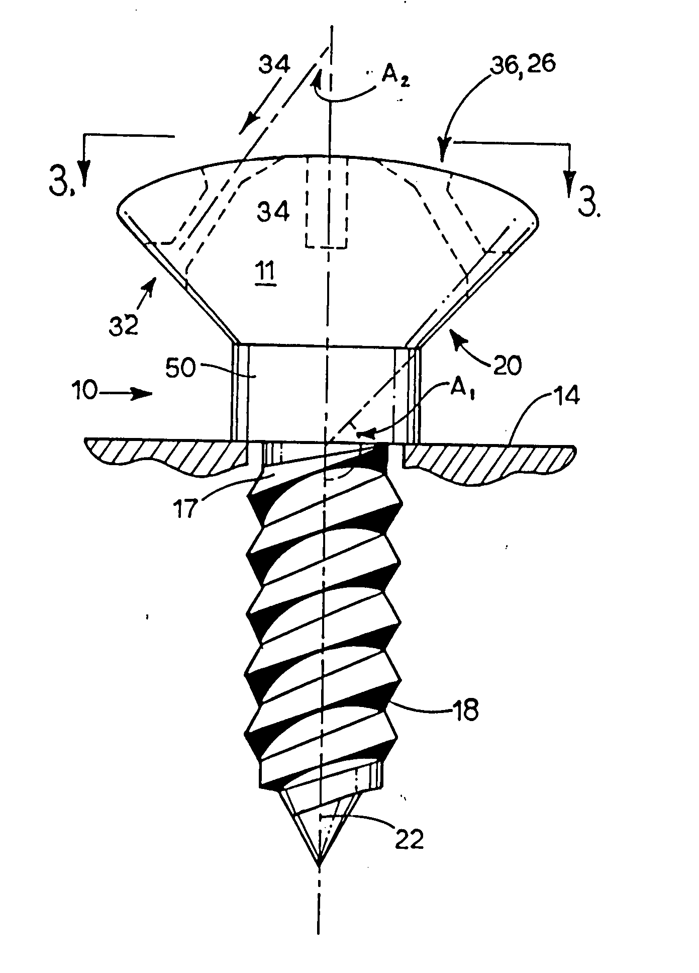 Soft tissue securing anchor