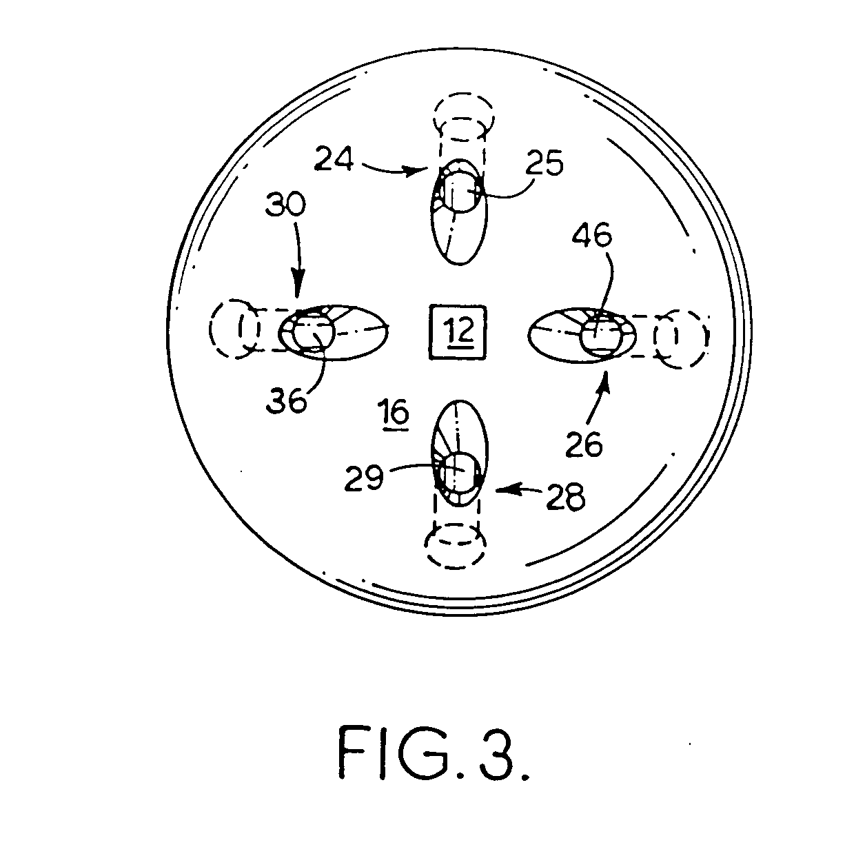 Soft tissue securing anchor