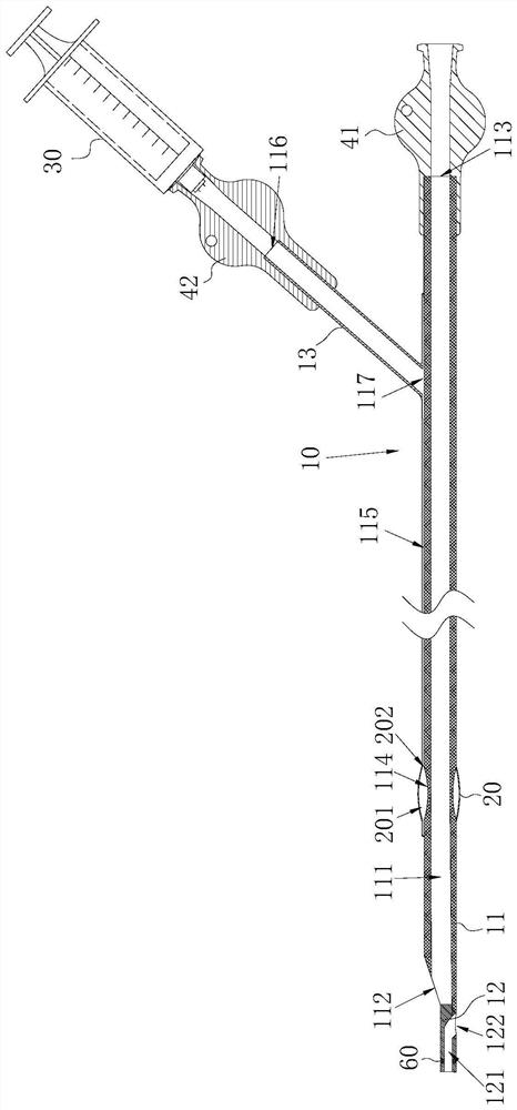 Suction catheter