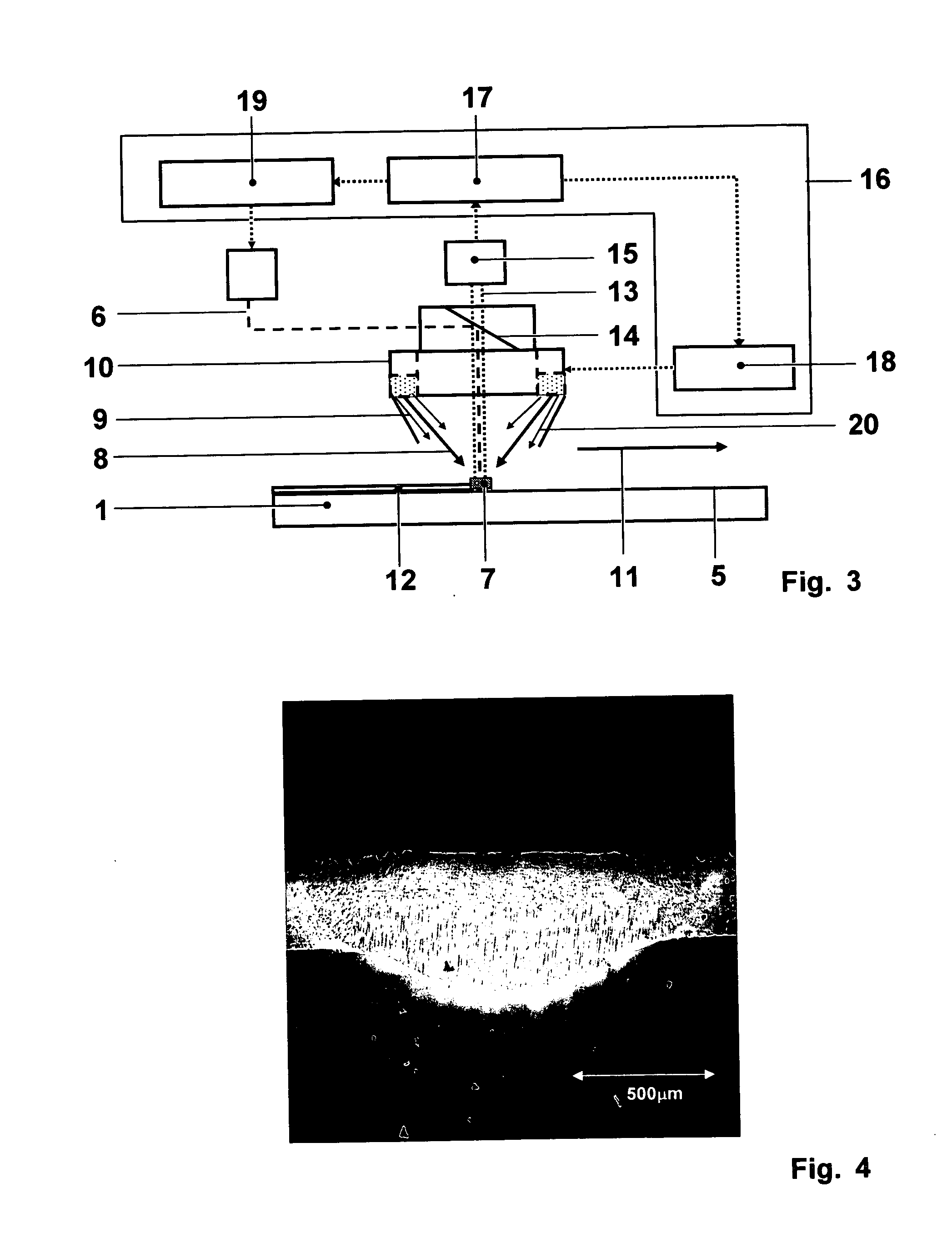 Method of controlled remelting of or laser metal forming on the surface of an article