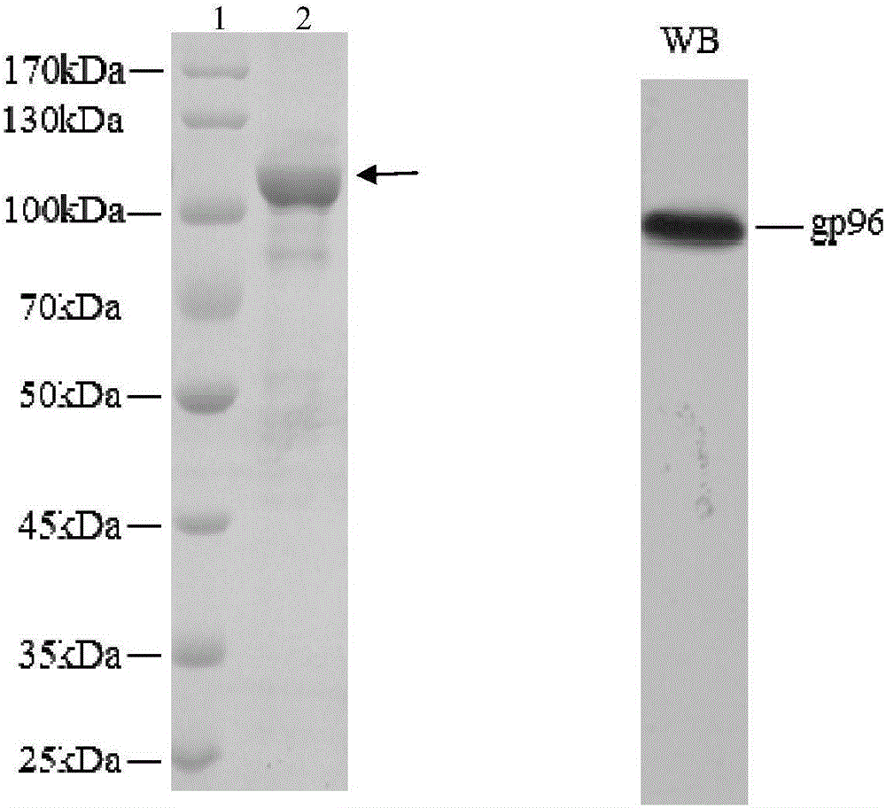 Application of heat shock protein gp96 in treatment of rheumatoid arthritis