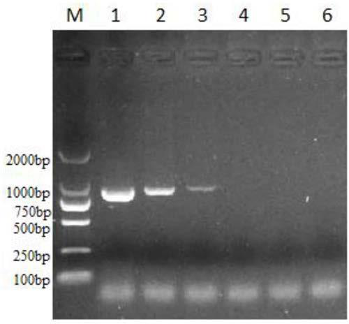 Method for simultaneously detecting multiple RT-PCR of GETV, PEDV, TGEV, PDCoV and PoRV