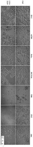 Strain of streptomycete CCPM7649 with strong anticancer activity and application thereof
