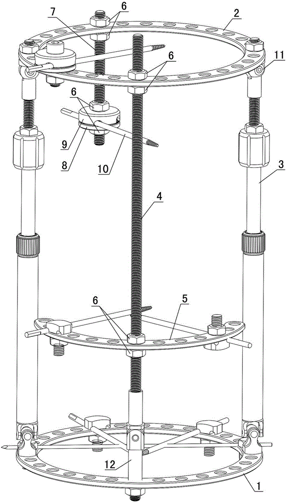 Regulation-control orthosis for coronal plane deformity of ankle