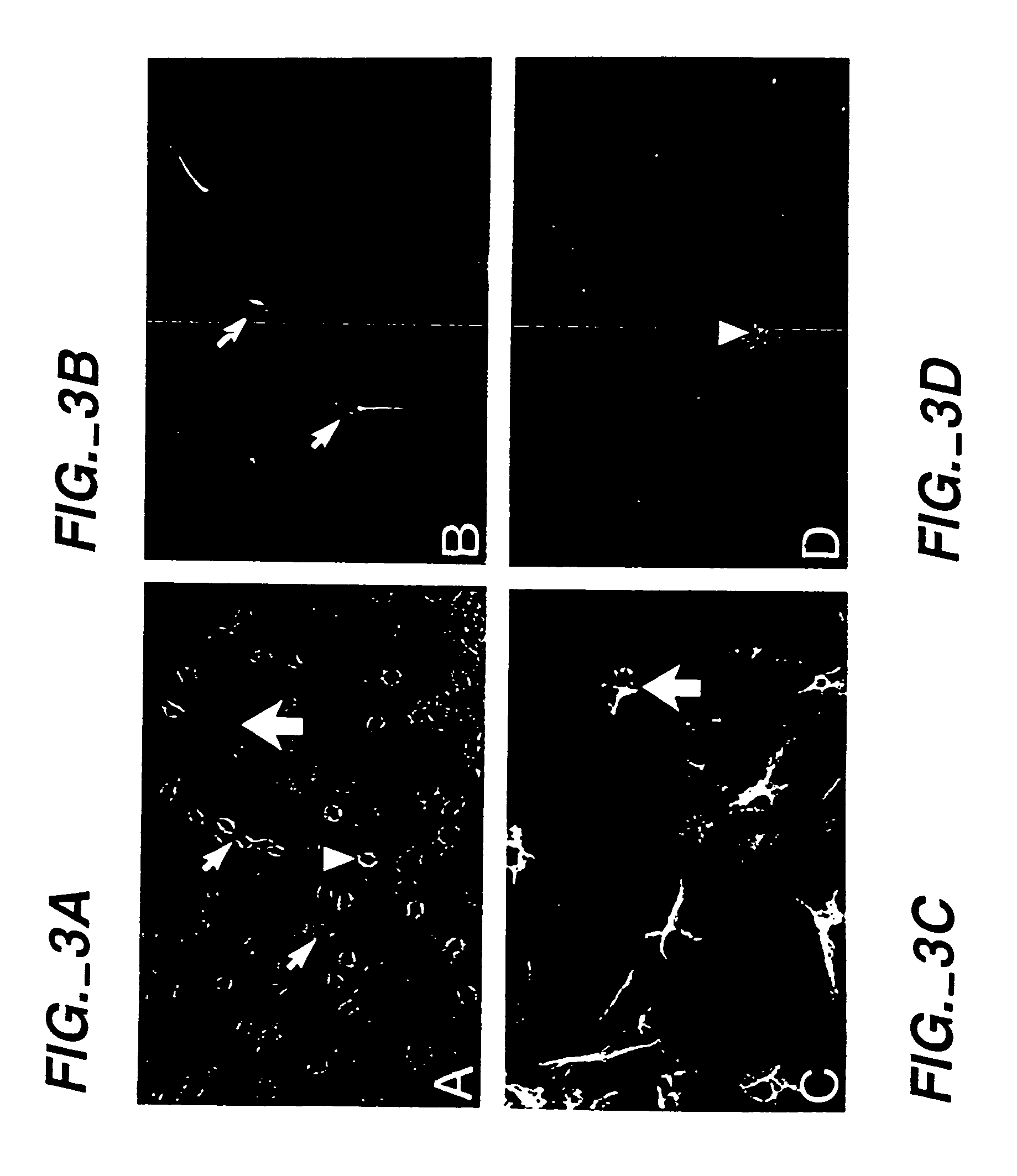 Methods of proliferating undifferentiated neural cells