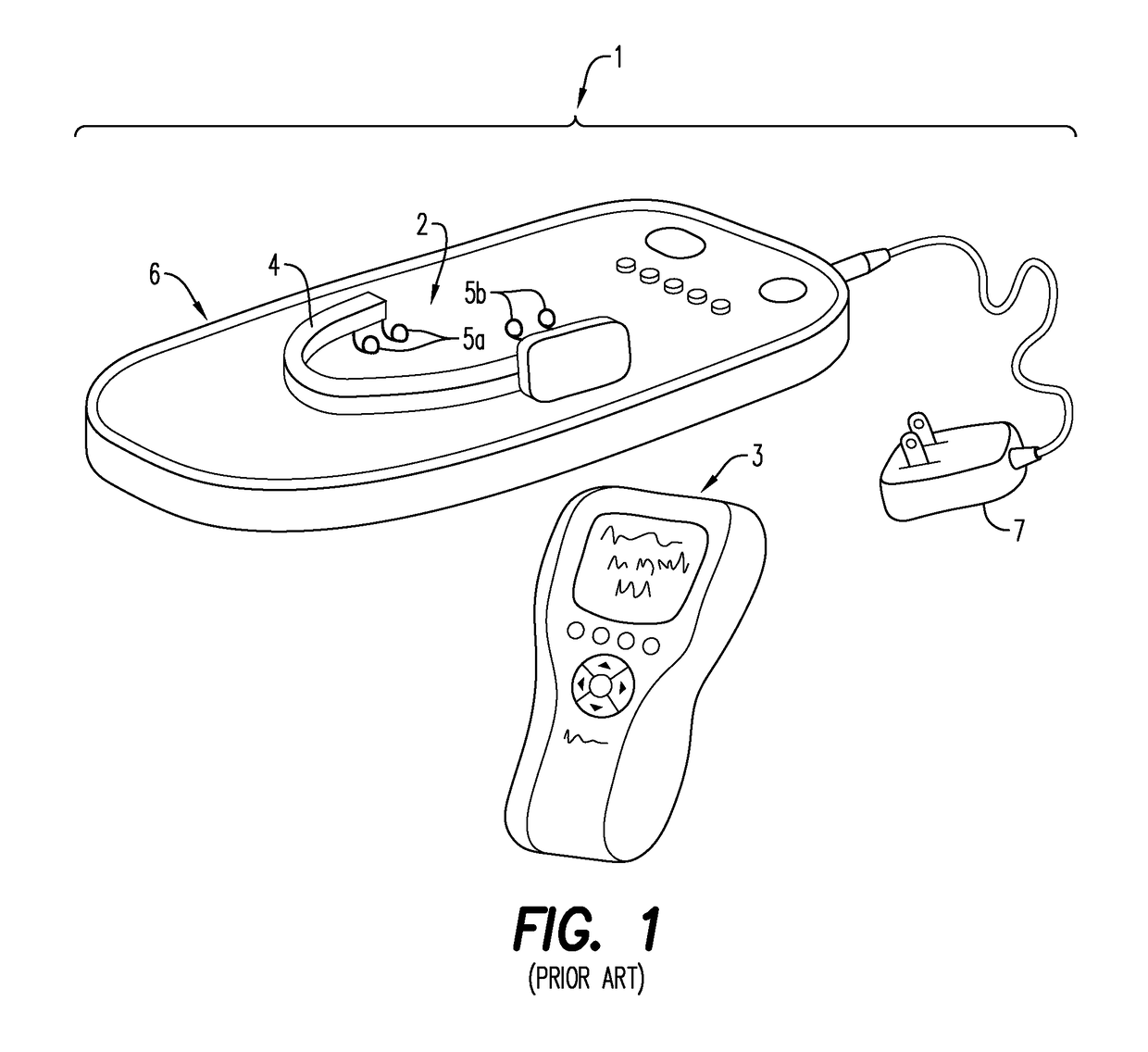 Removable mandibular myo-stimulator