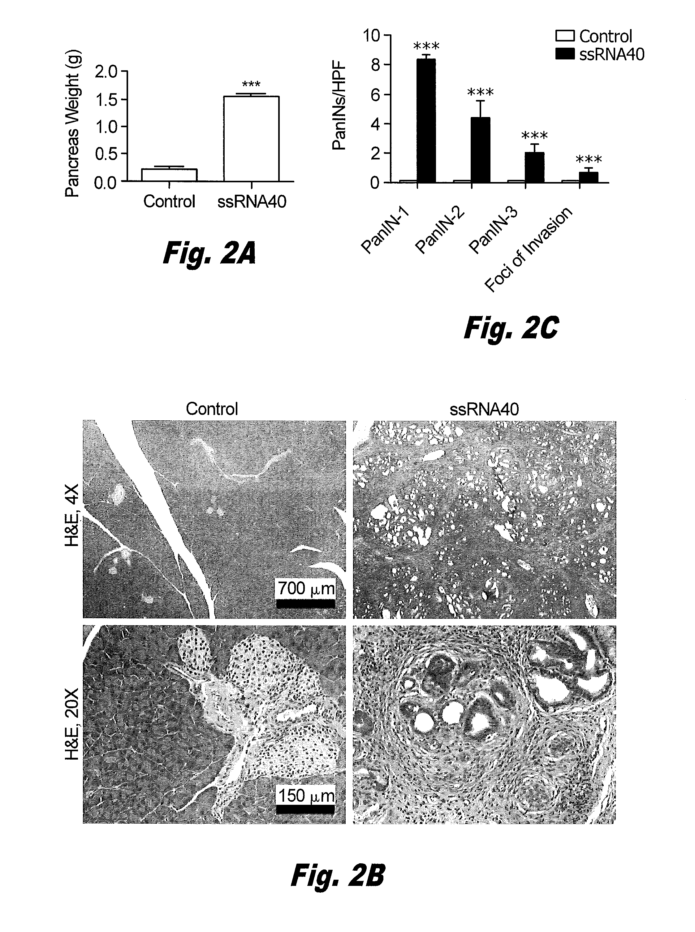 Inhibition of pattern recognition receptors in pancreatic cancer treatment using tlr inhibitors