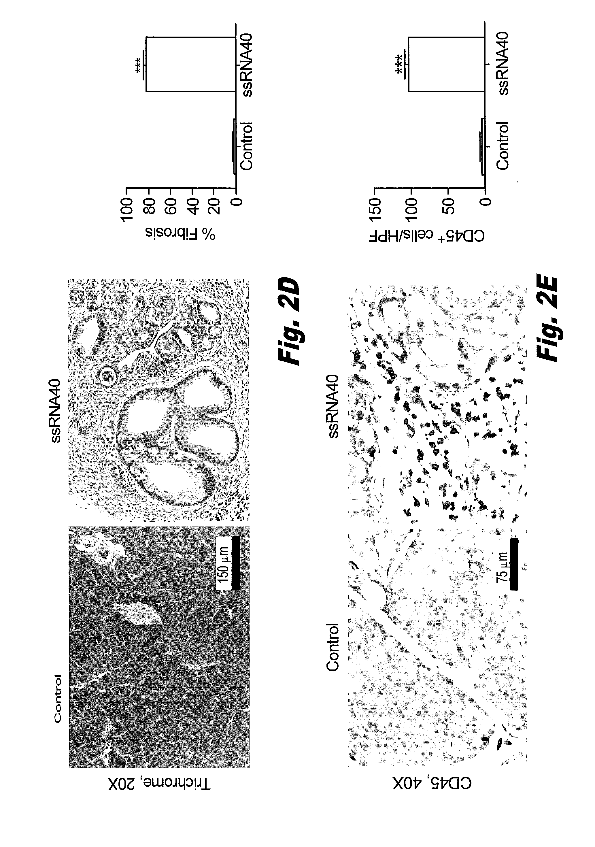 Inhibition of pattern recognition receptors in pancreatic cancer treatment using tlr inhibitors