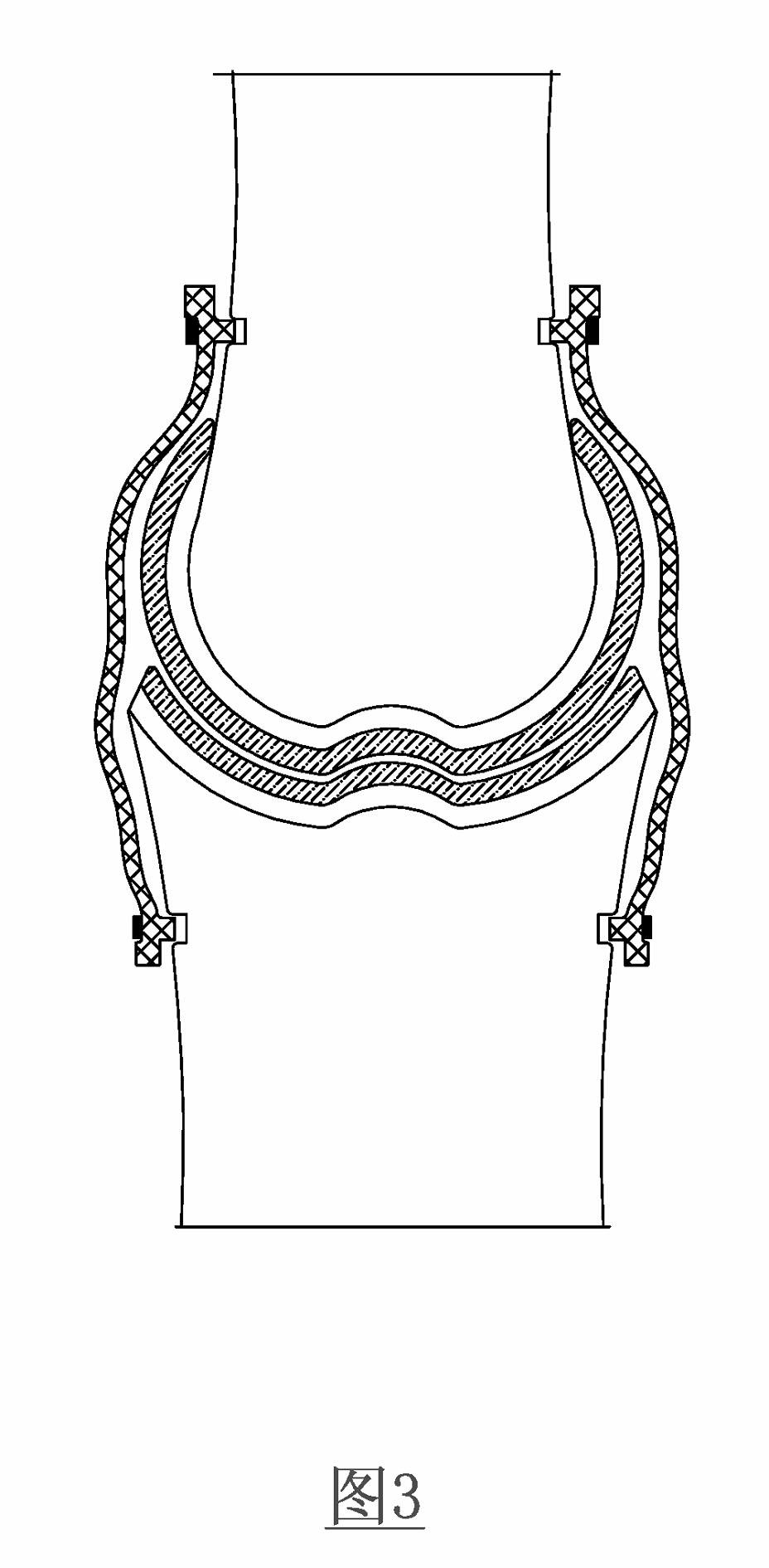 Bionic joint device of closed lubrication