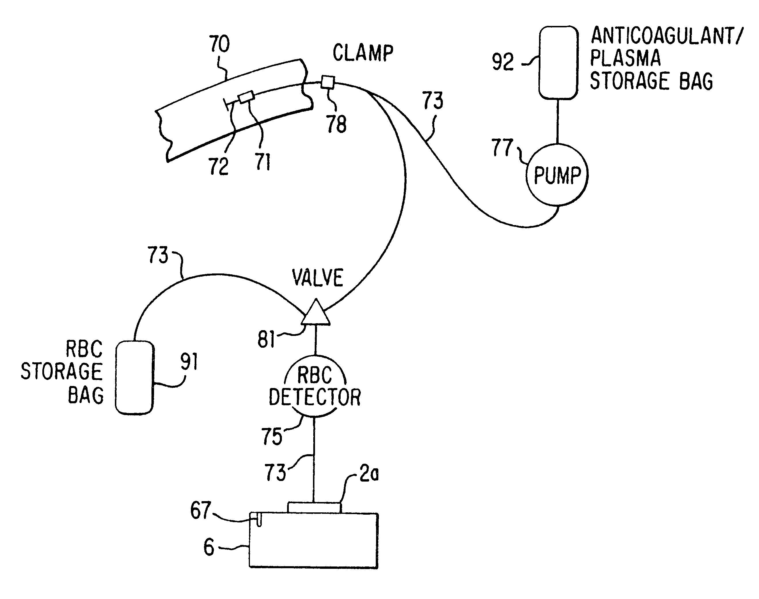 Blood collection and separation system