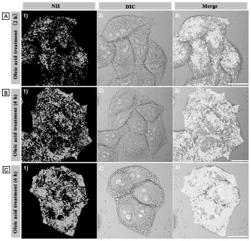 An ultra-selective and amphiphilic lipid droplet fluorescent probe and its application