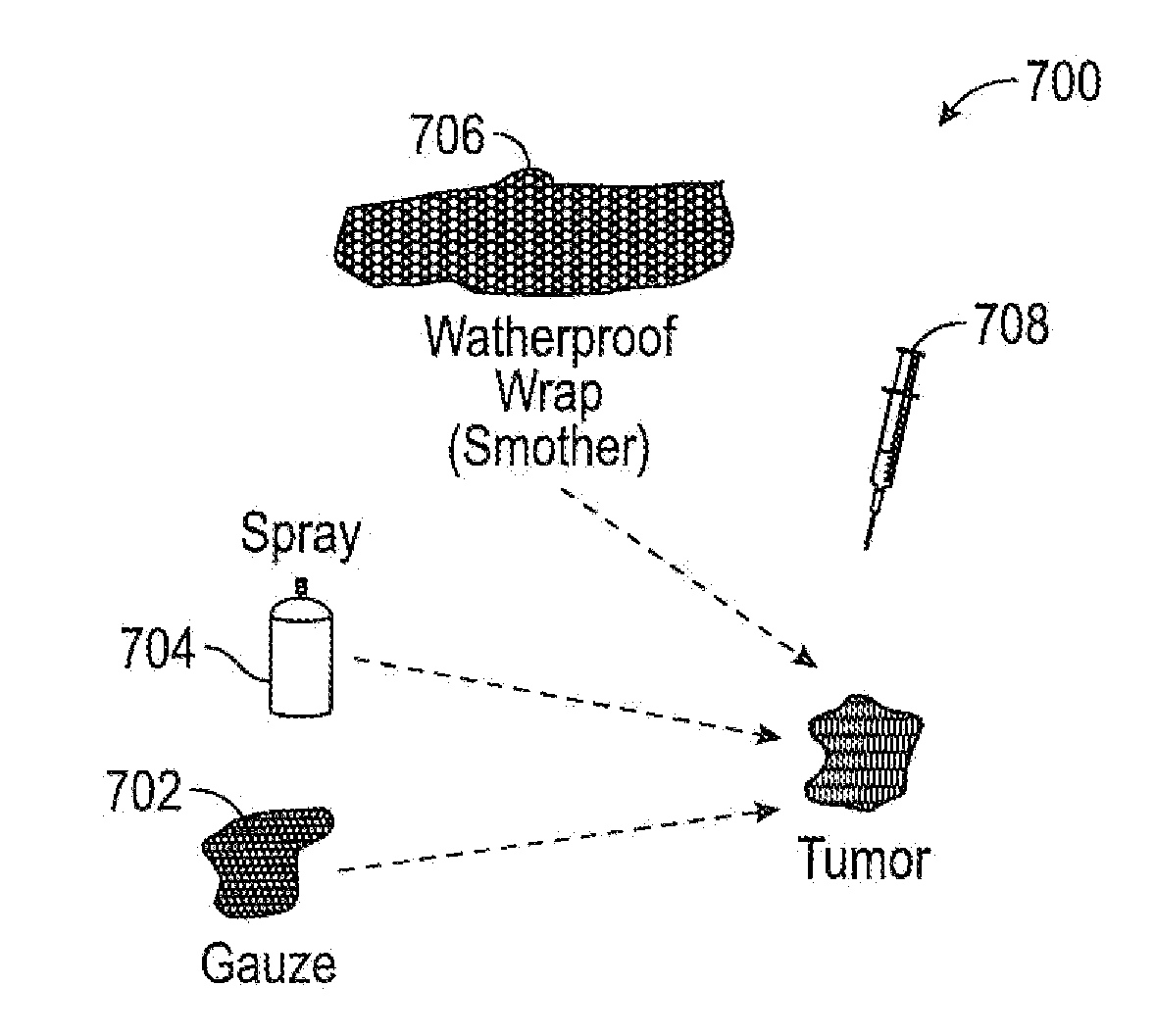 Rapid destruction of malignant tumors by excitotoxicity and osmotic-shock medical tactics