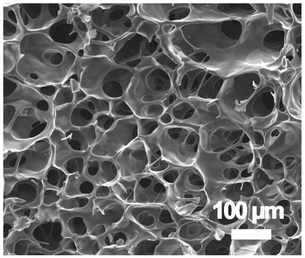 Multifunctional injectable hydrogel for tumor photo-thermal treatment and bone tissue repair and preparation method