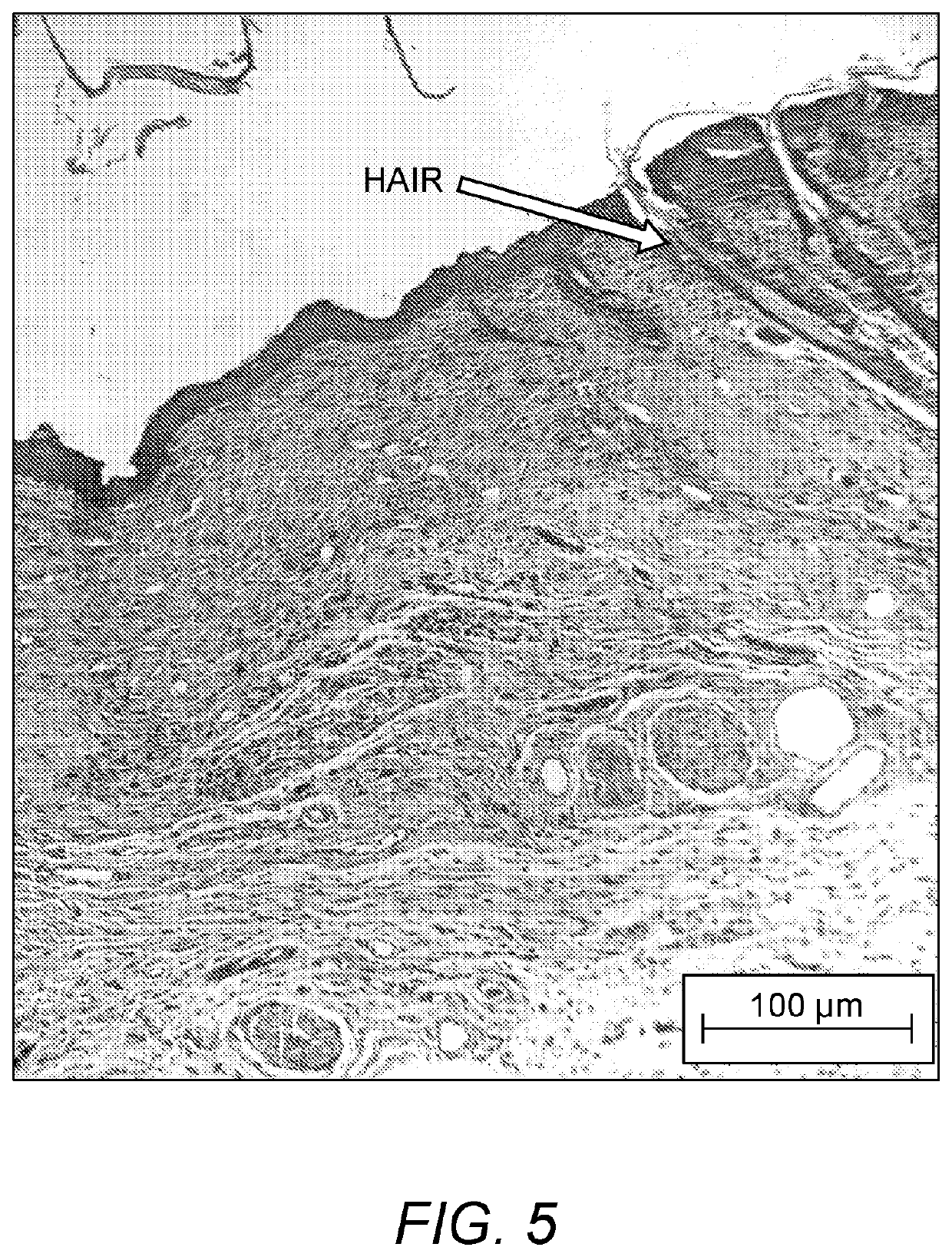 Multi-layer skin substitute products and methods of making and using the same