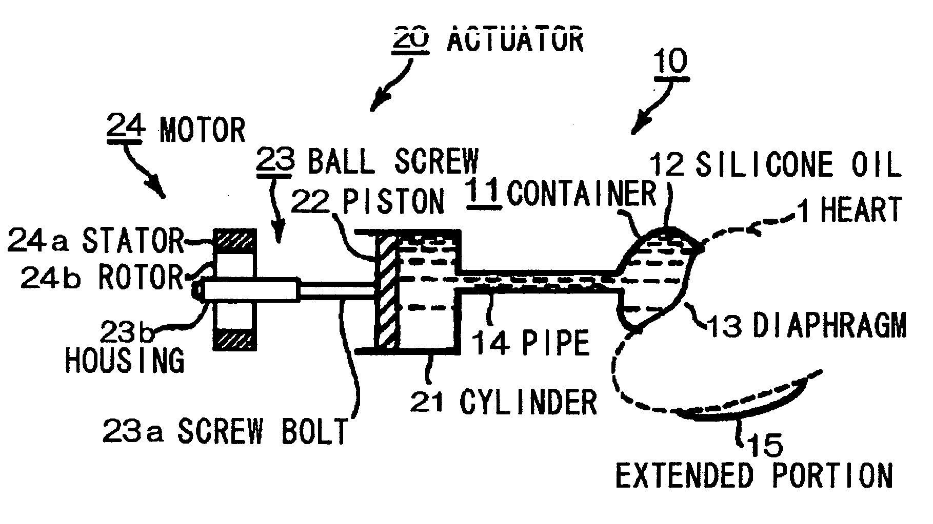 Artificial myocardial device assisting motion of heart