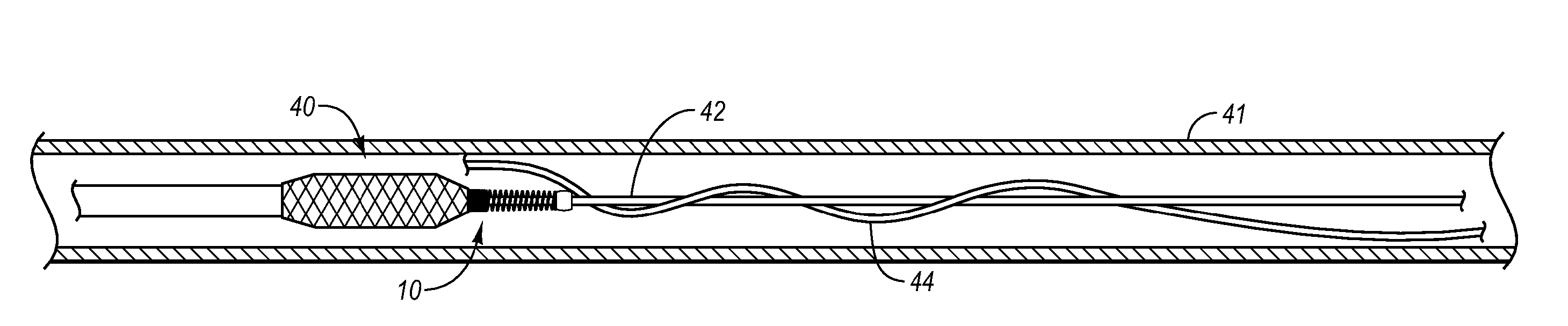 Flexible catheter tip having a shaped head