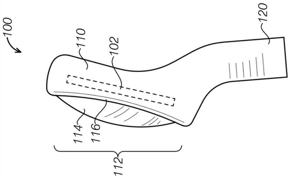 Ultrasound device with attachable components