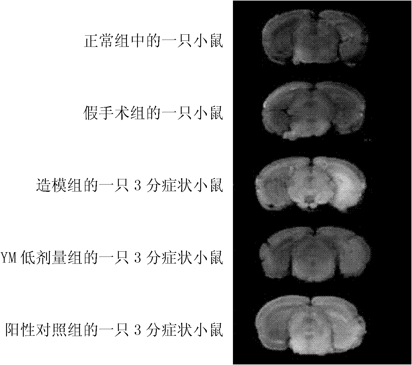 Novel application of Jingzhaotoxin