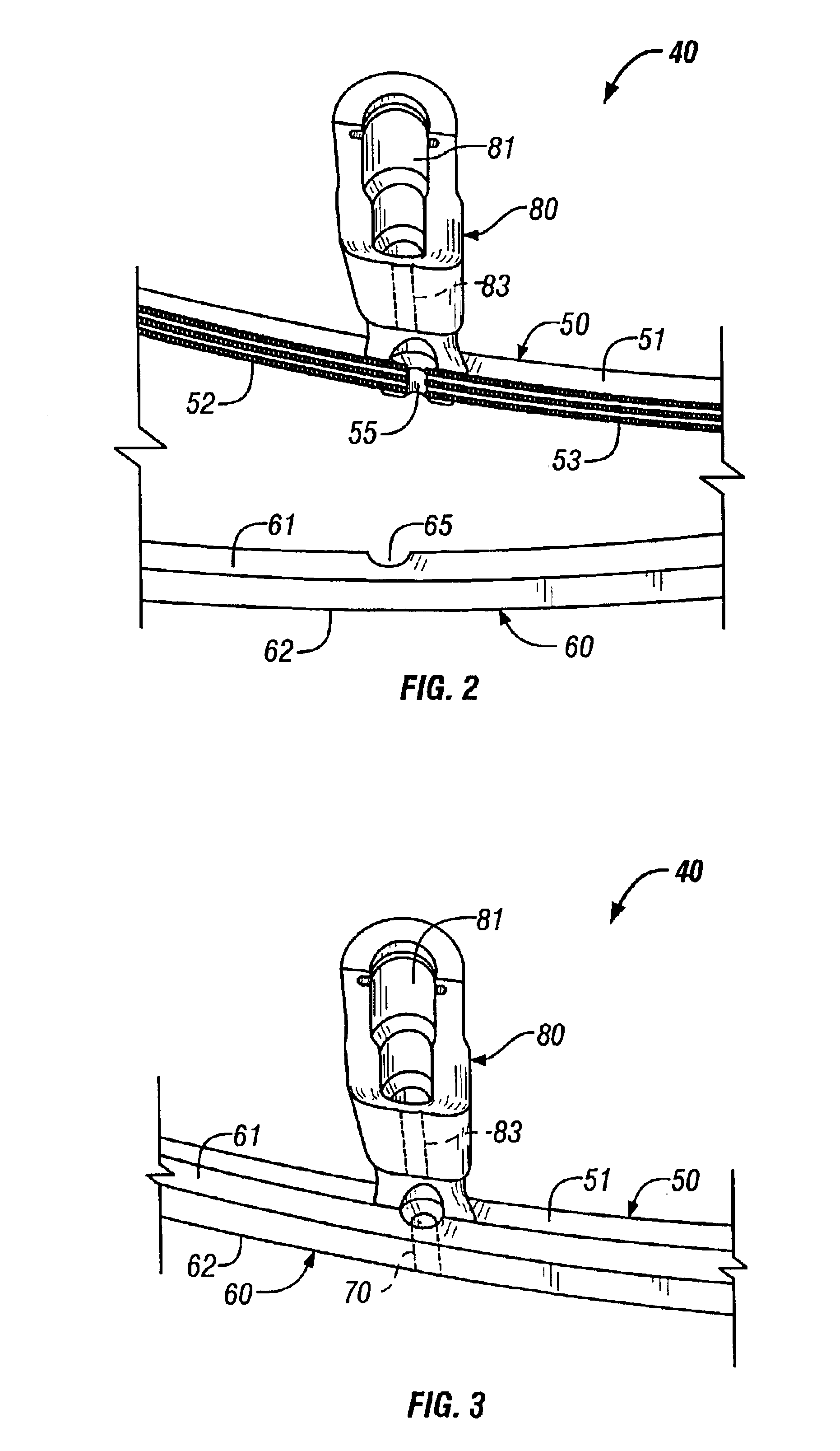 Infusion clamp