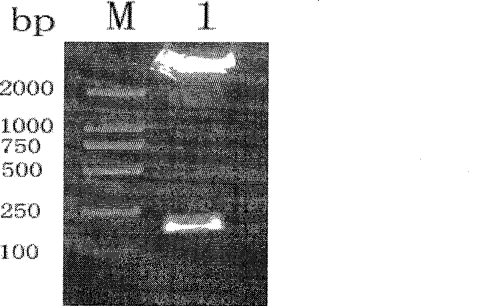 Pig's epidermal growth factor gene and its application