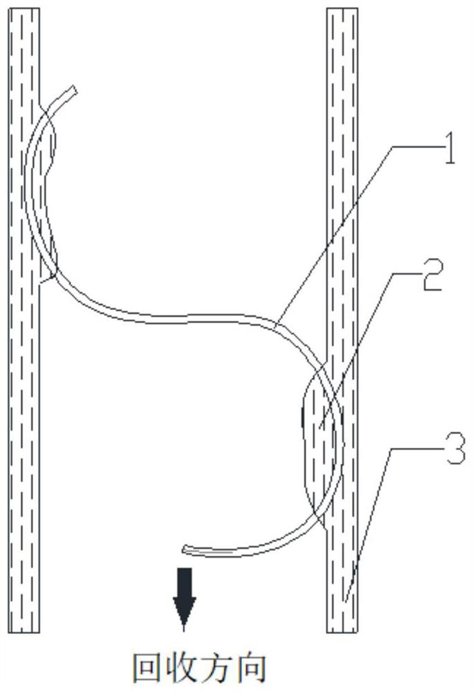 Recoverable vena cava filter