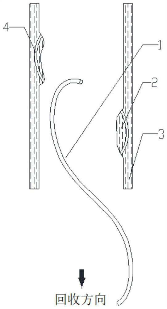 Recoverable vena cava filter