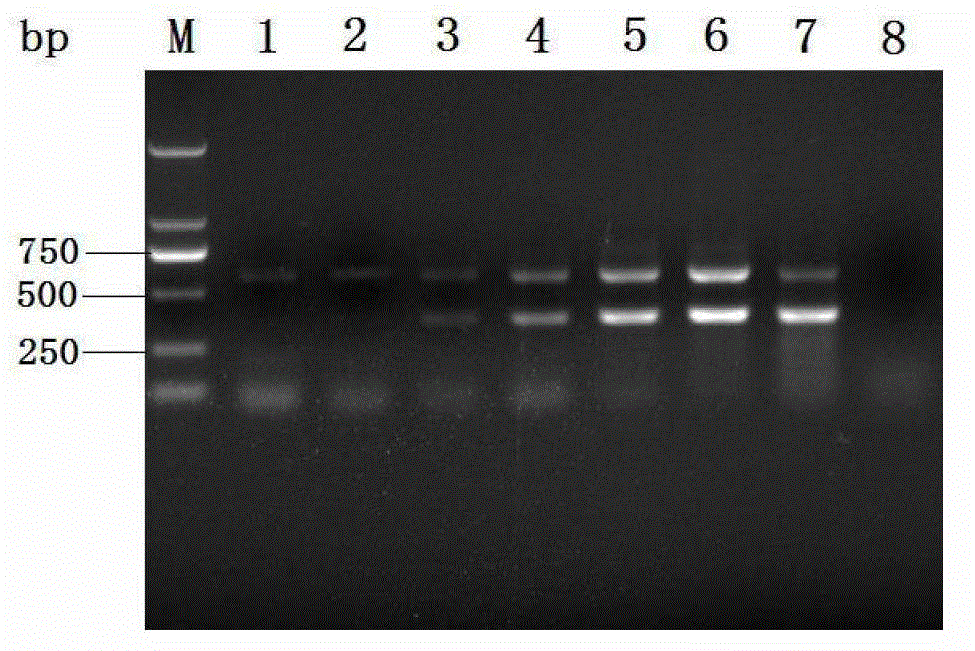 Duplex polymerase chain reaction (PCR) detection primer group, kit and method for pathogenic channa source aeromonas schubertii