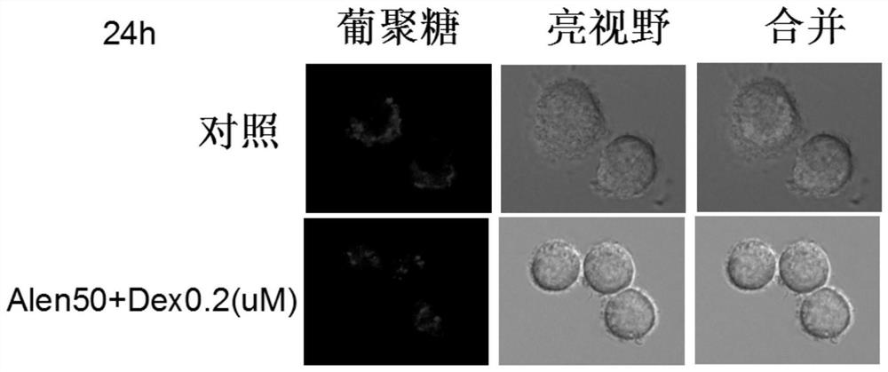 Application of nitrogenous bisphosphonate combined glucocorticoid in prevention or treatment of viral pneumonia