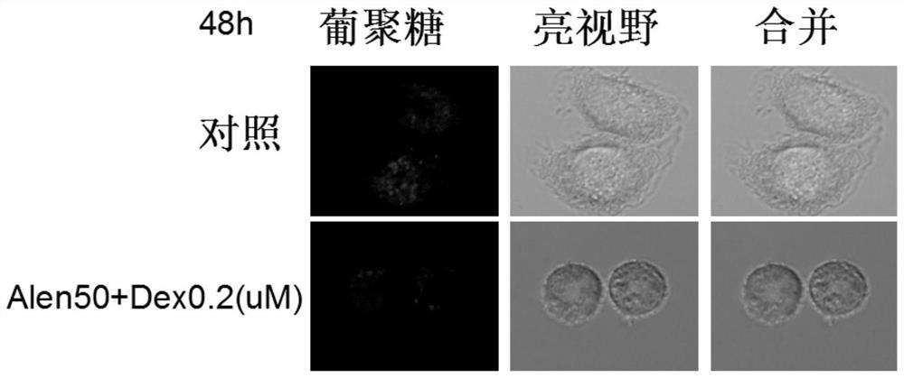 Application of nitrogenous bisphosphonate combined glucocorticoid in prevention or treatment of viral pneumonia