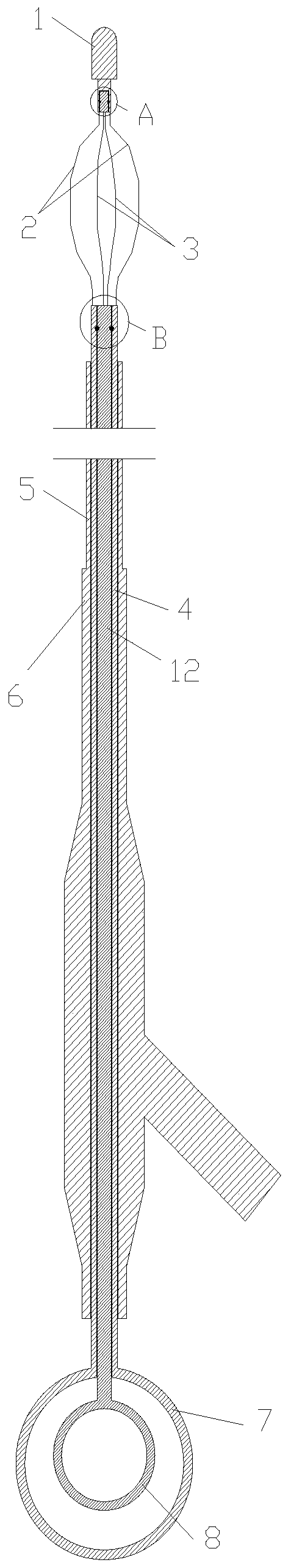 Calculus removing device for hepatobiliary surgery