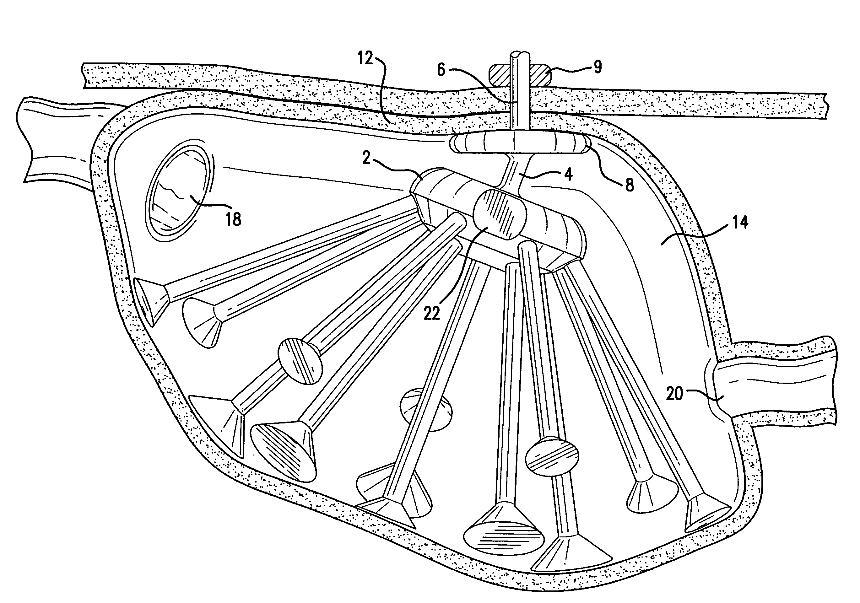 Method of inducing satiety