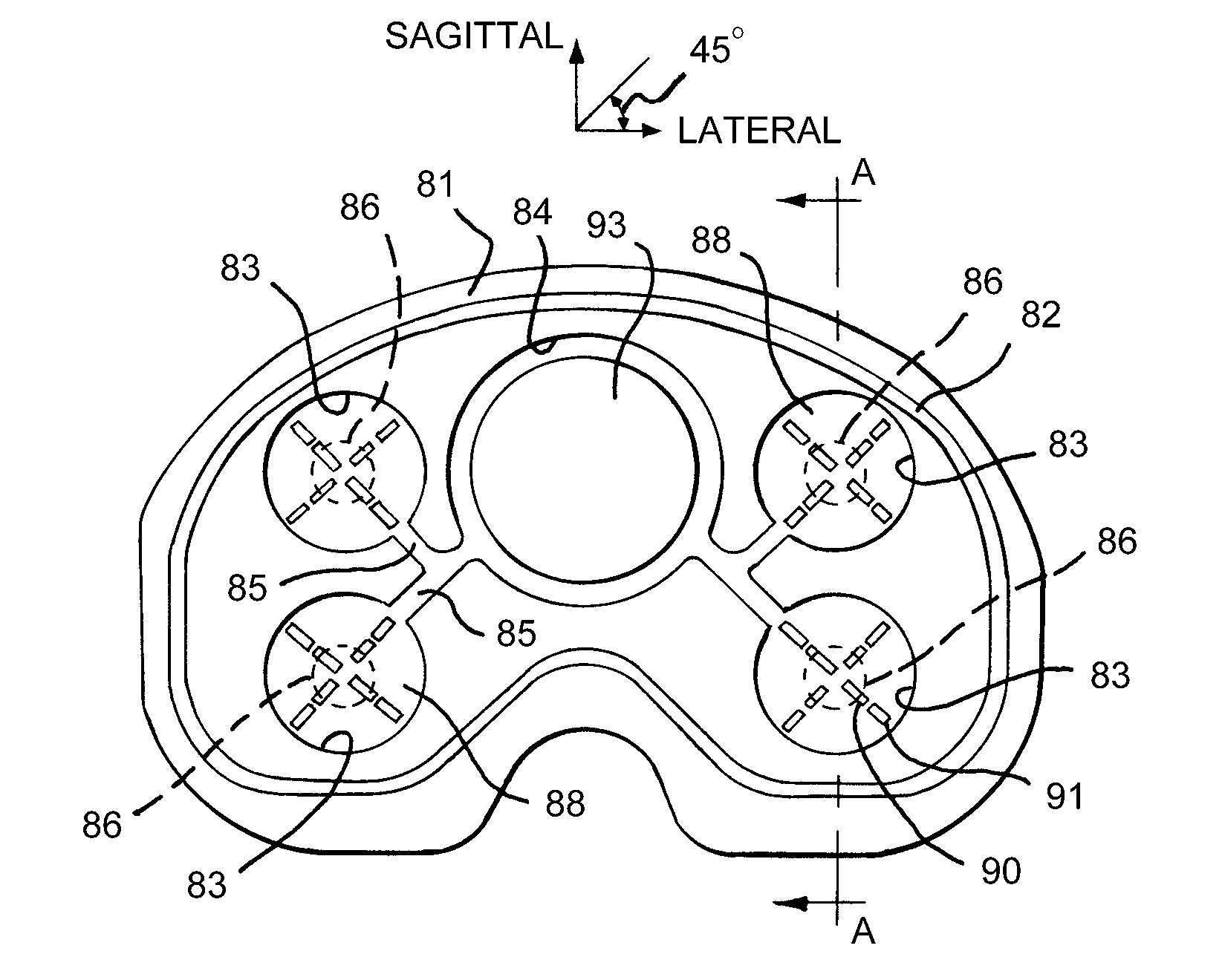 Telemetric tibial tray