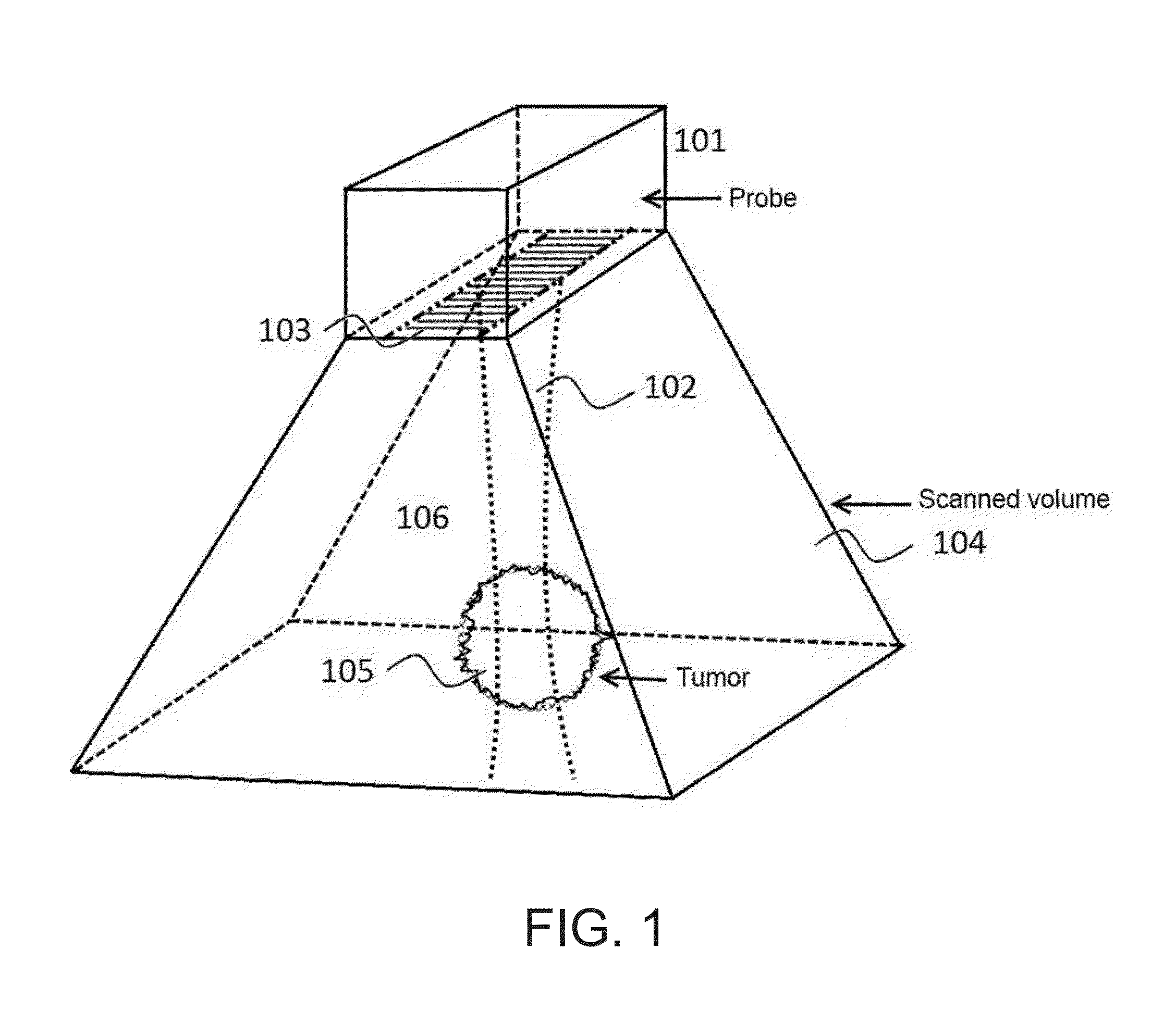 Instrument and method for ultrasound mediated drug delivery