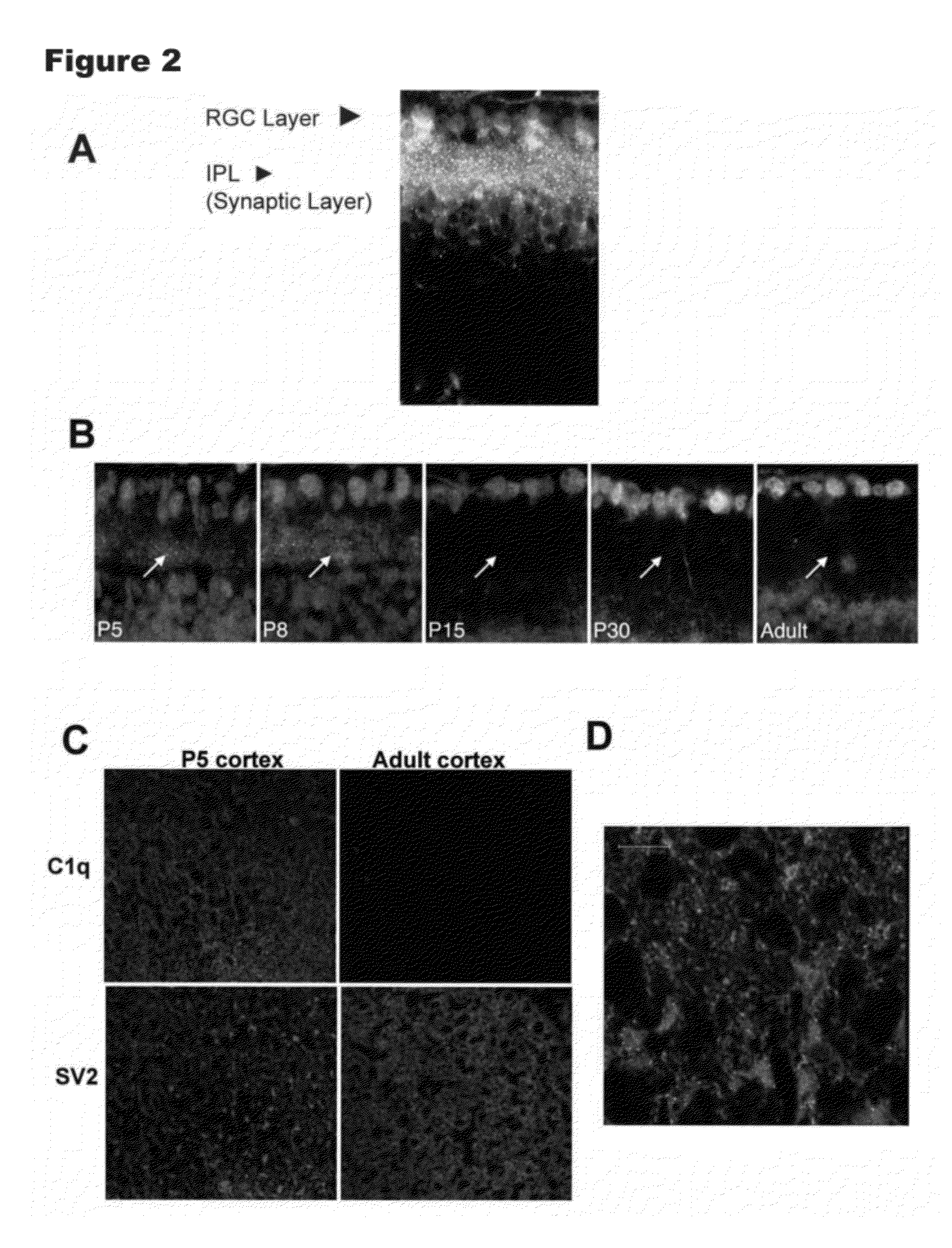 Modulation of Synaptic Maintenance