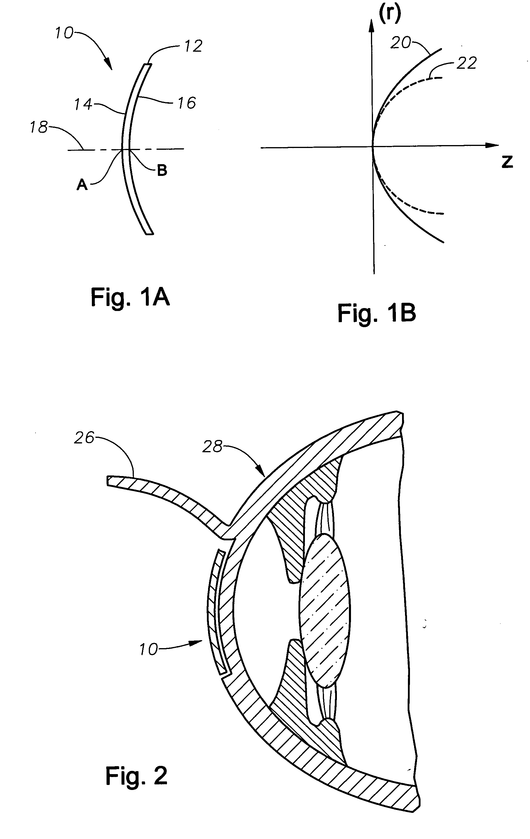 Aspheric lenticule for keratophakia