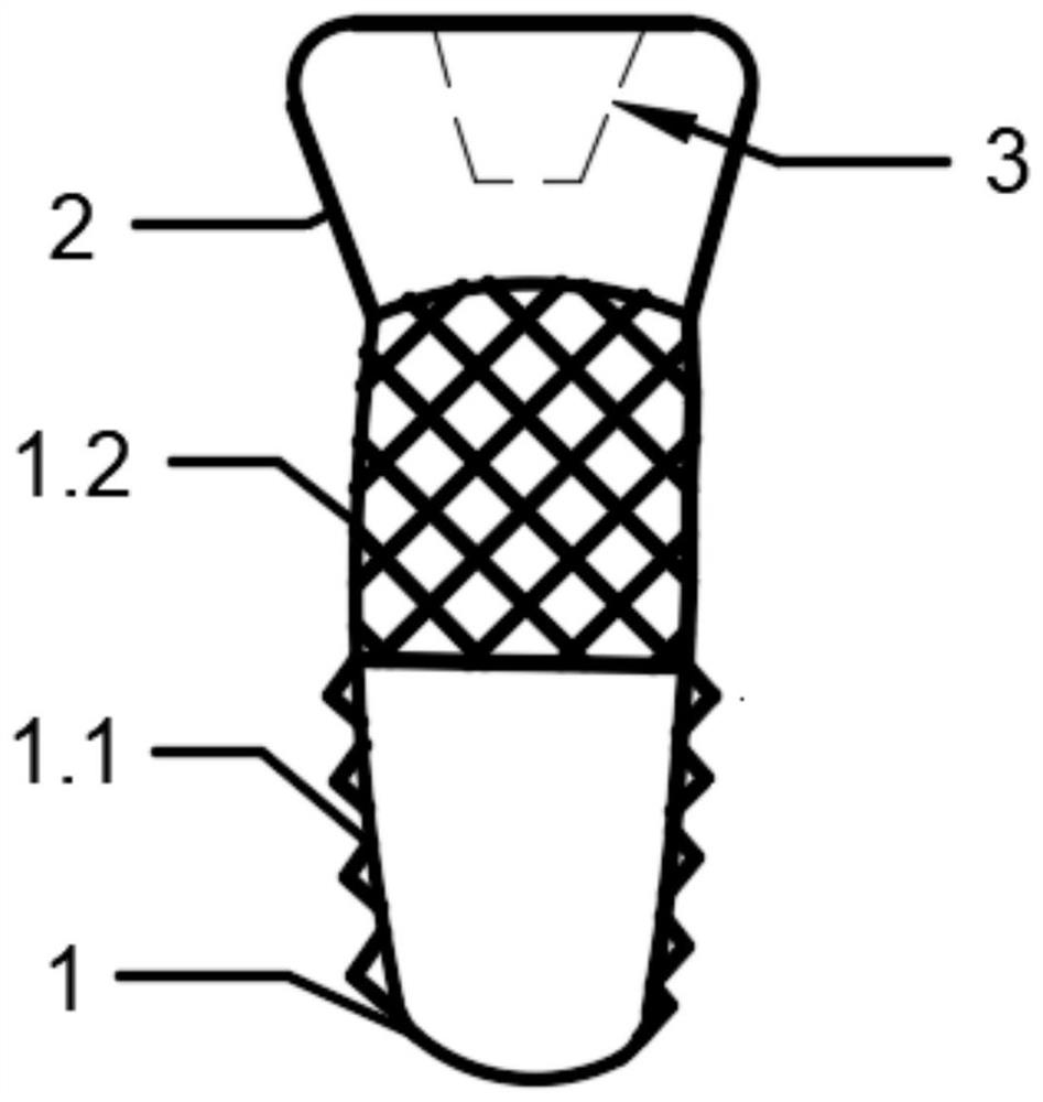 Integrated dental implant and preparation method thereof