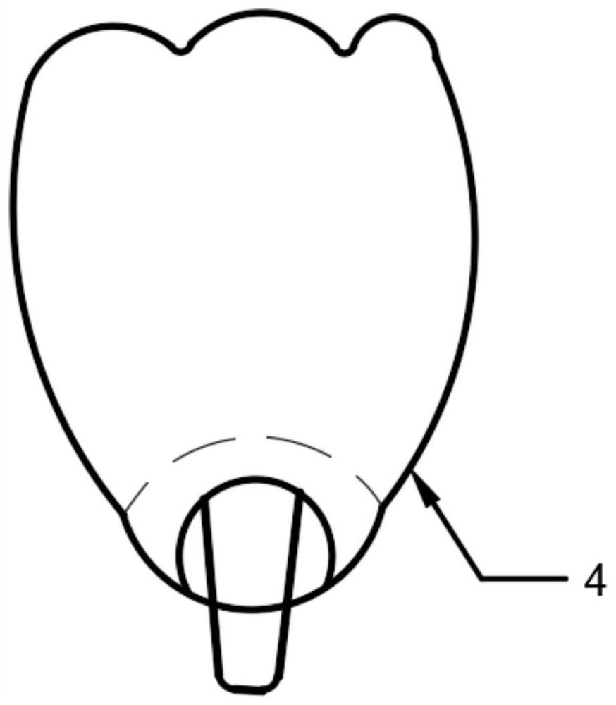 Integrated dental implant and preparation method thereof