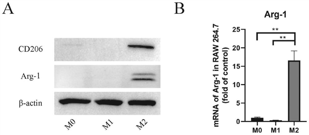 Macrophage-derived exosome preparation for resisting inflammation and promoting tissue regeneration and preparation method and application of macrophage-derived exosome preparation