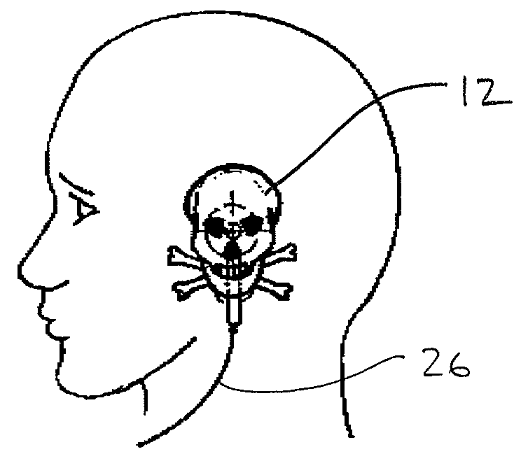 Earbud Assembly and Method of Decorating an Earbud Assembly